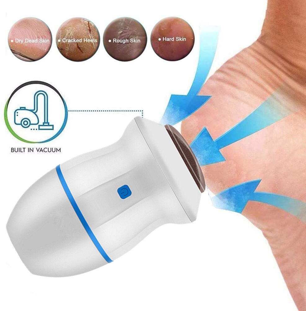 Electric Vacuum Foot Grinder: Dead Skin & Callus Remover