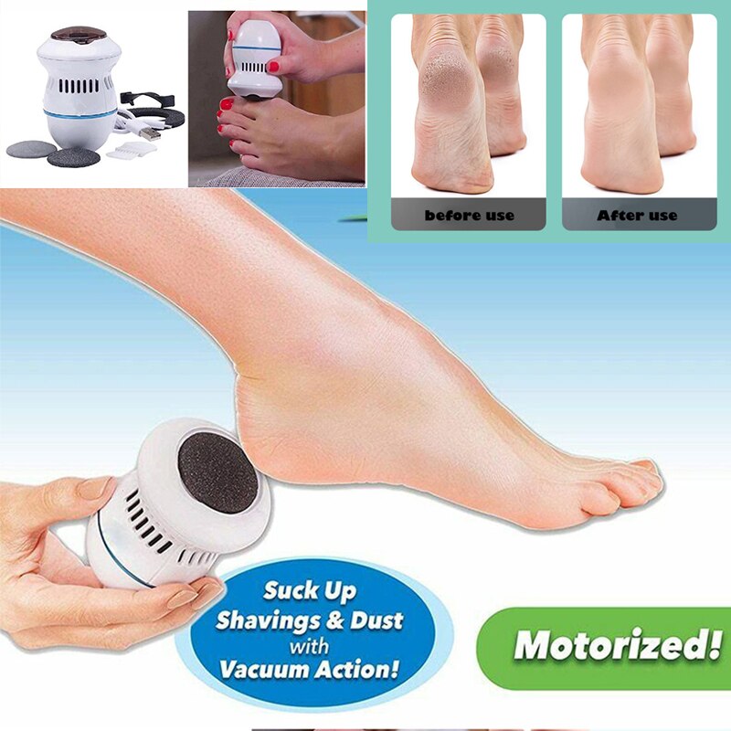 Electric Vacuum Foot Grinder: Dead Skin & Callus Remover