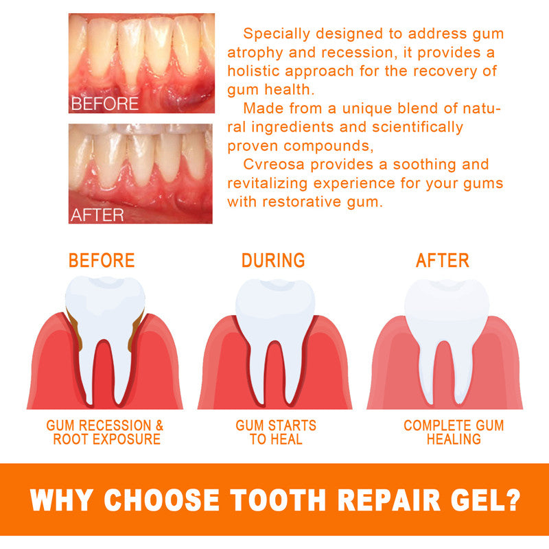 Teeth Repair Deep Cleaning Teeth Yellow Teeth Stain Tartar Care Gum Oral Care